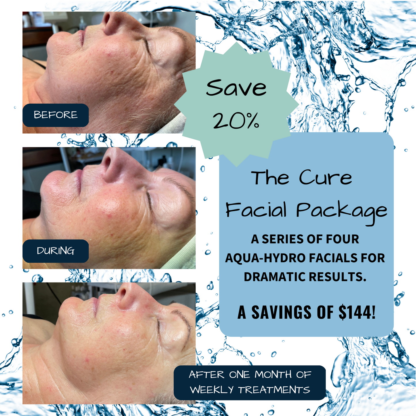 The Cure Aqua Hydro Facial Package